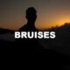 Bruises